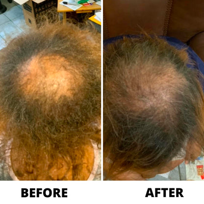 Allurium Hair Growth Serum