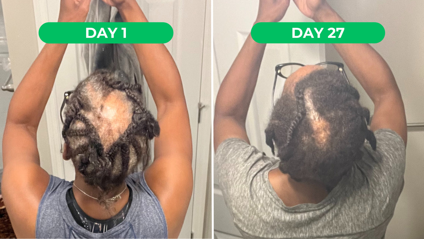 Allurium Hair Growth Serum